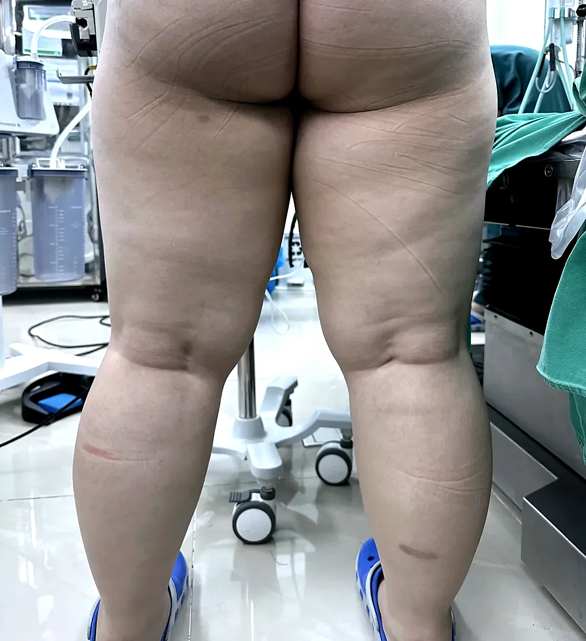 Before surgery