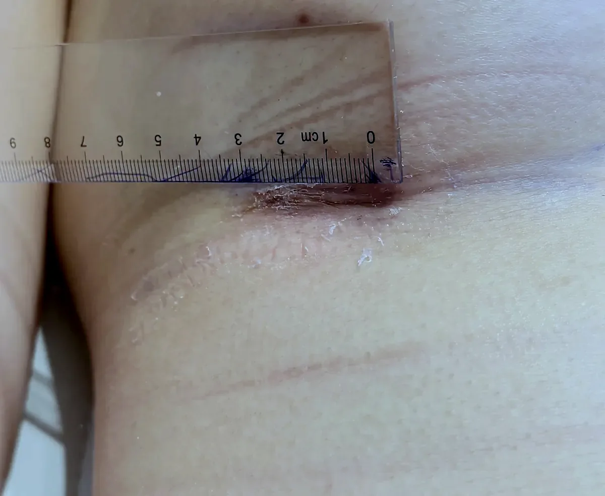 Before surgery