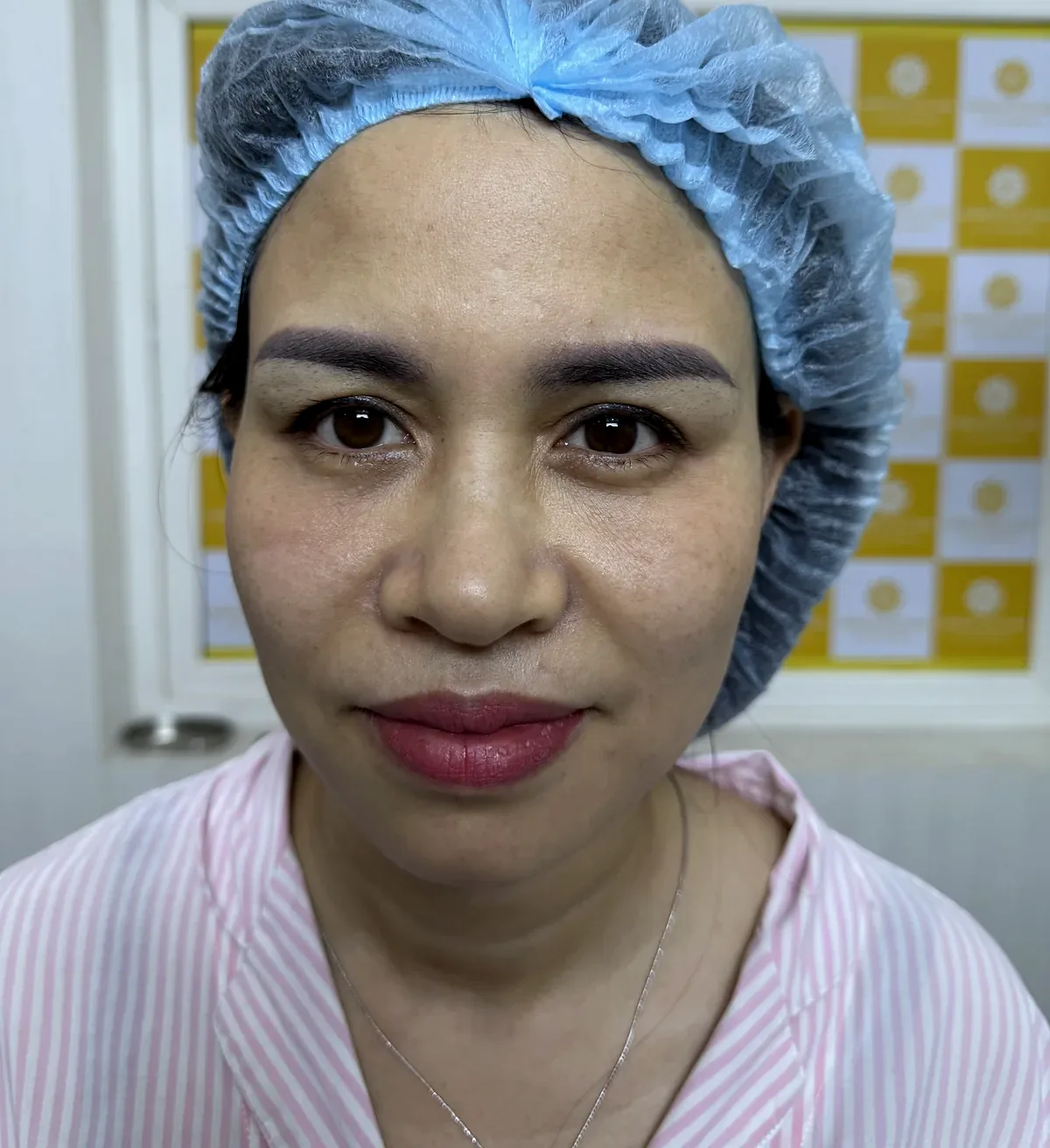 Before surgery