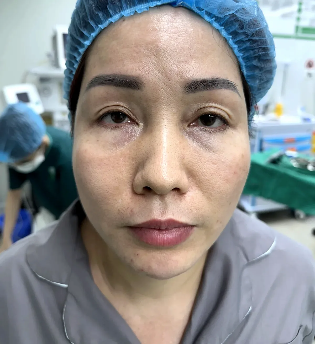 After surgery