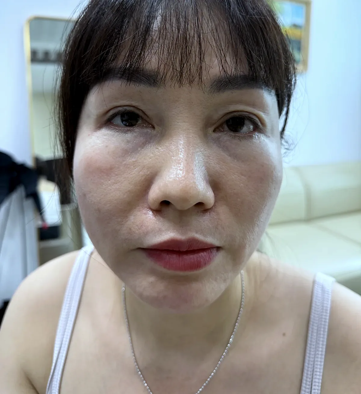 Before surgery