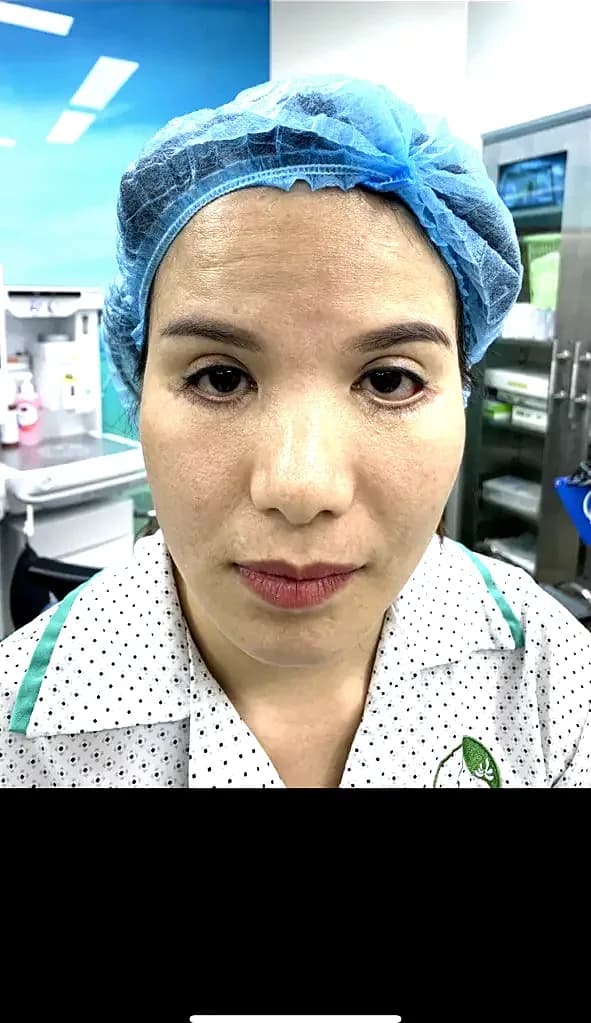 Before surgery