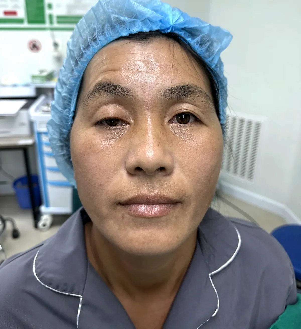 Before surgery