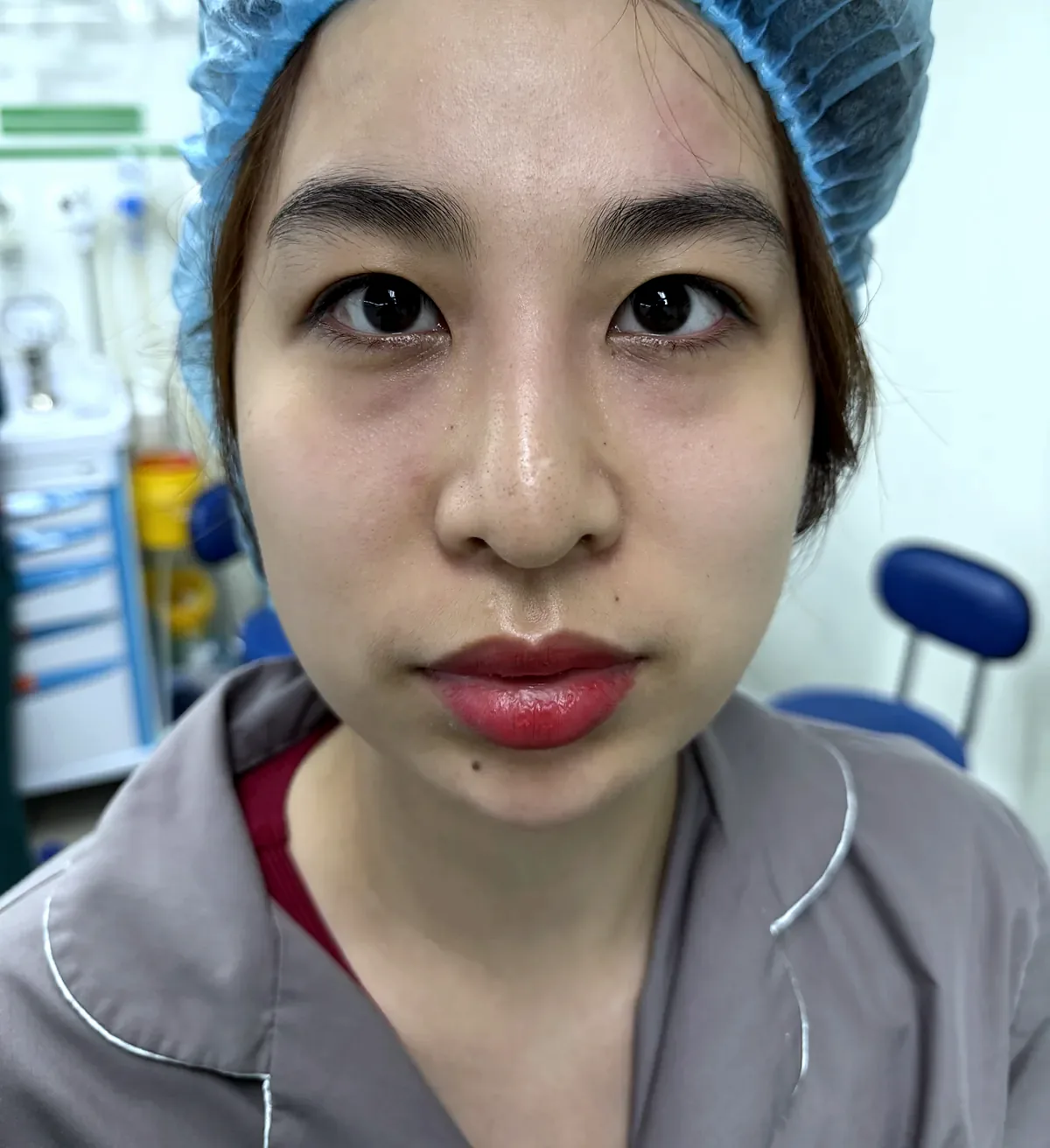 Before surgery