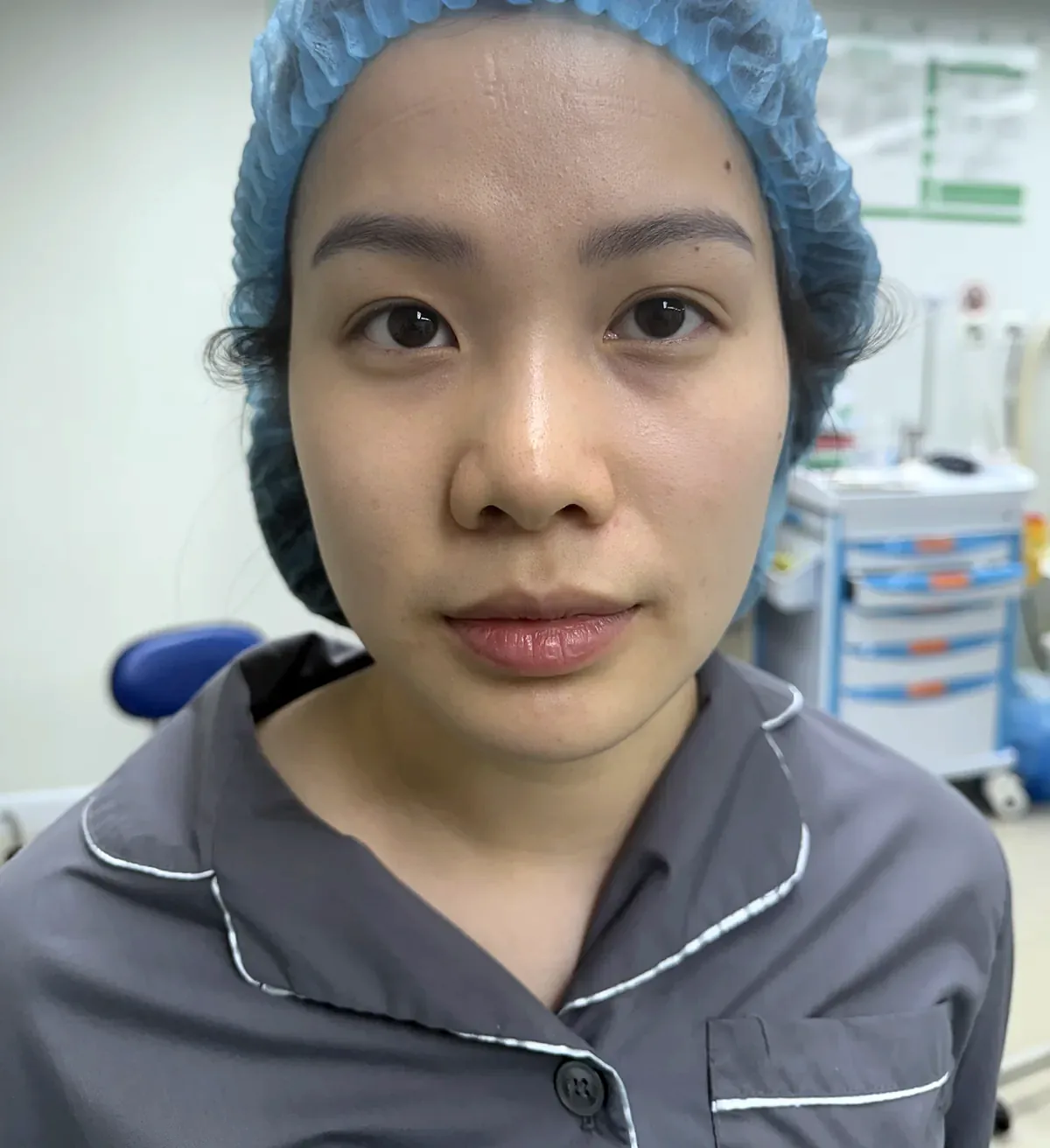 Before surgery
