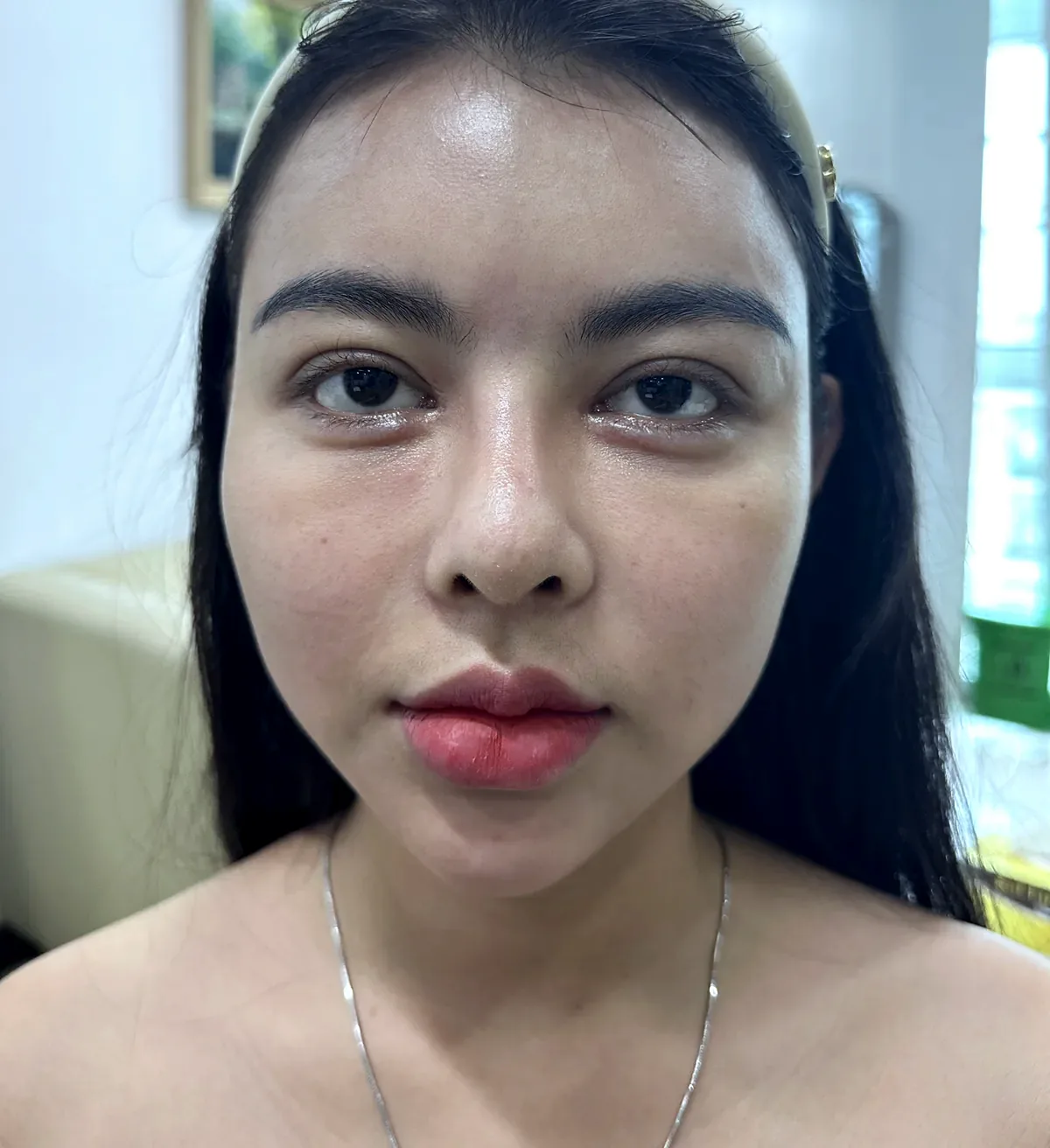 Before surgery