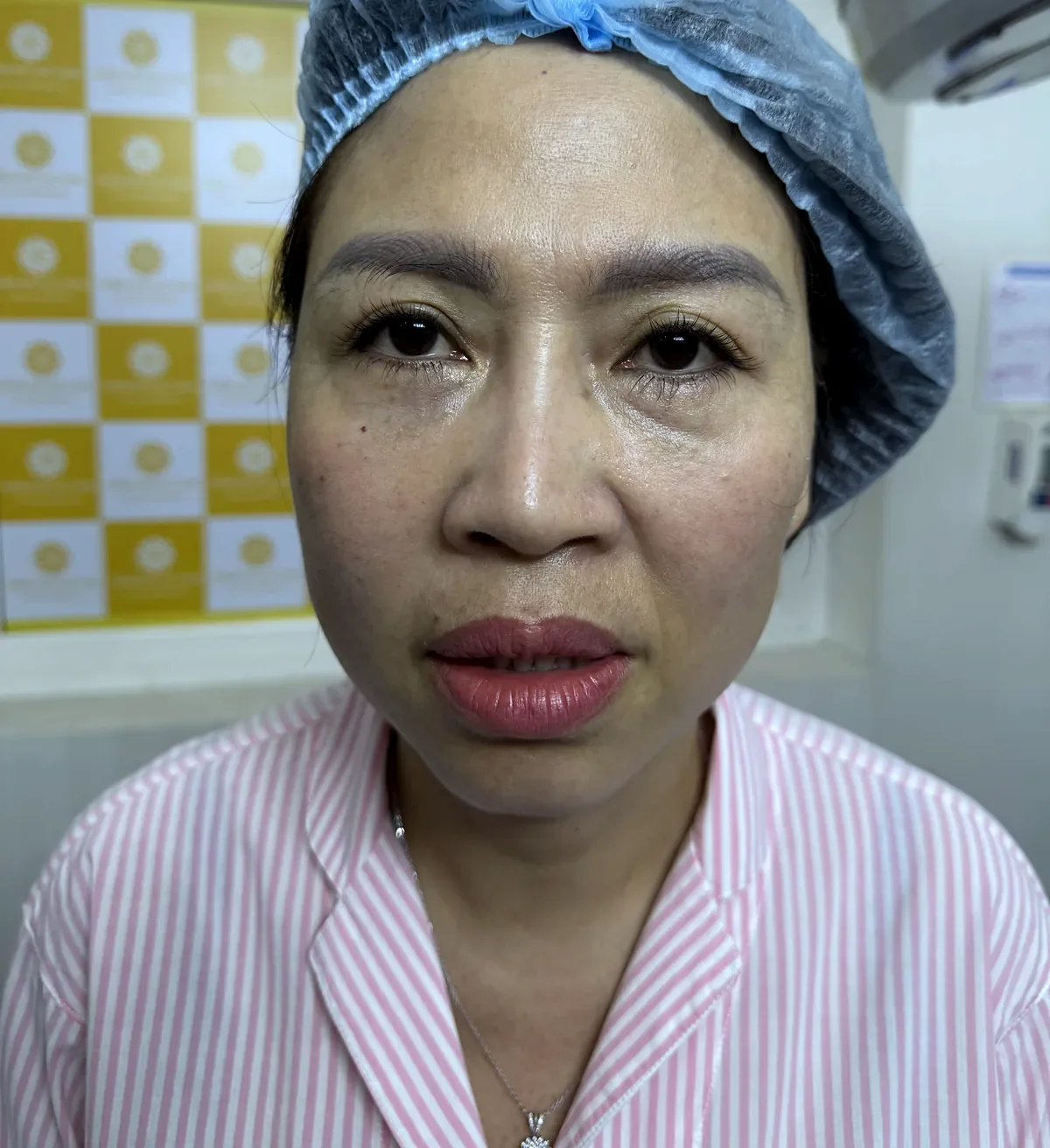 Before surgery