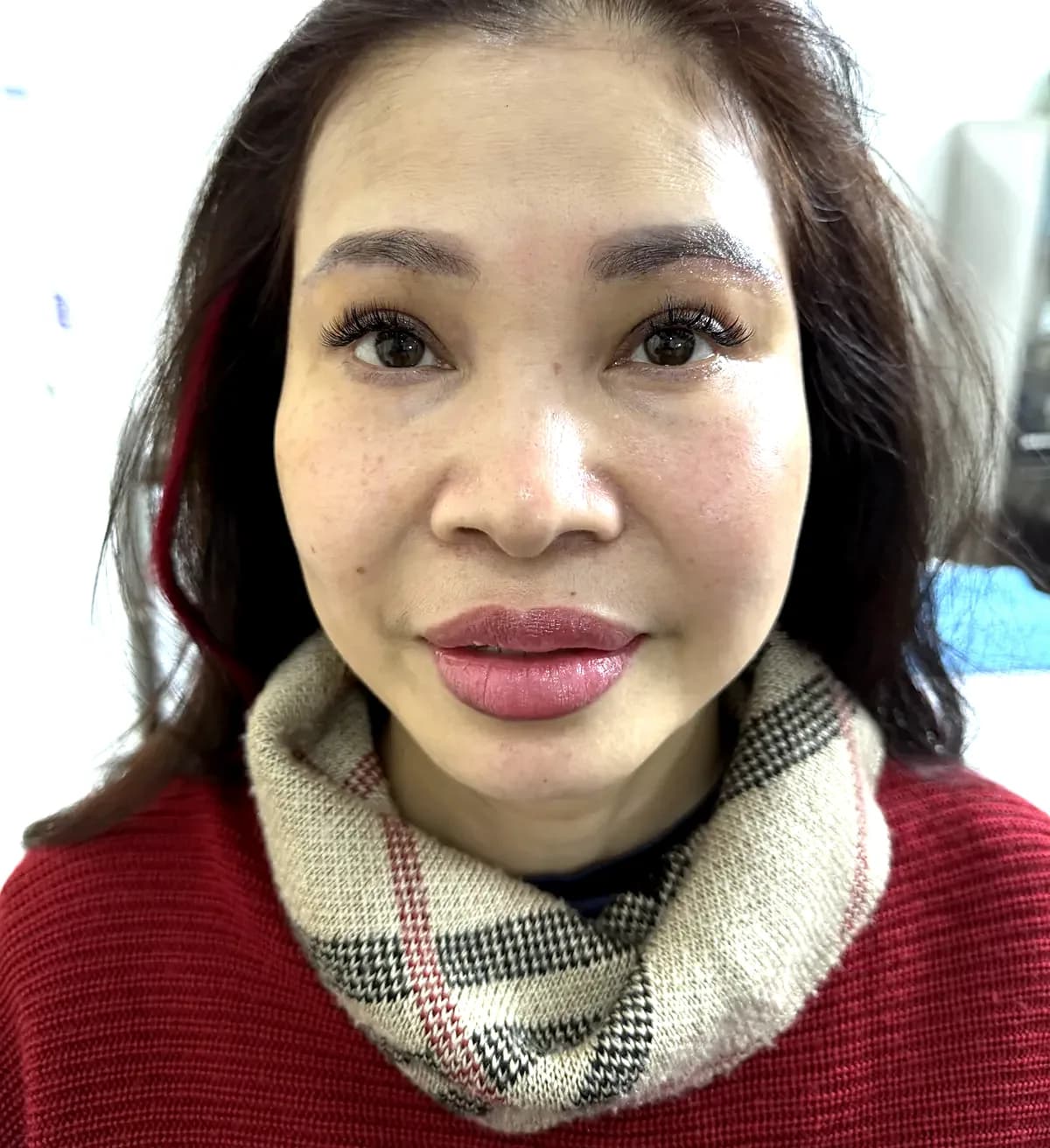 After surgery