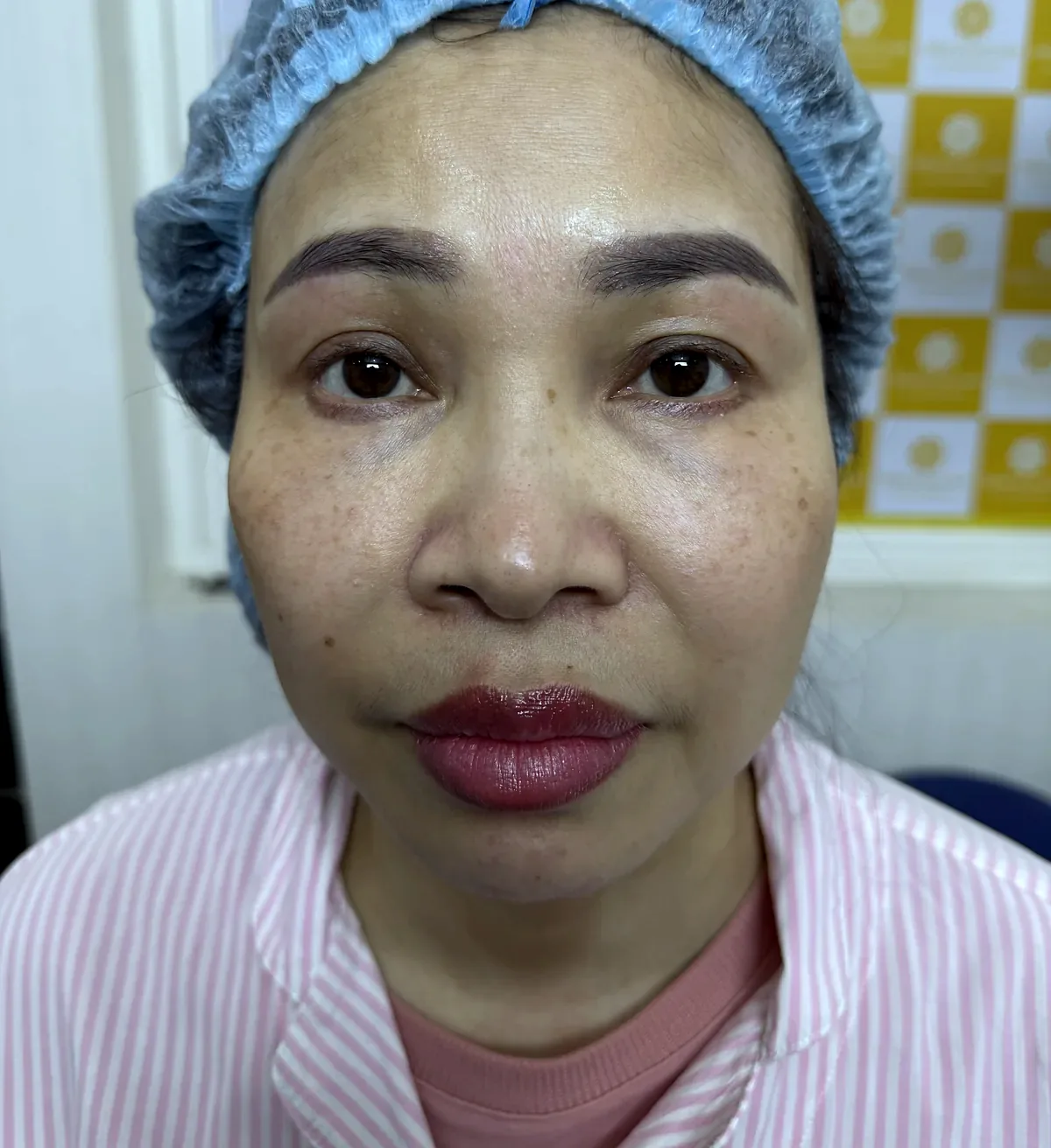 Before surgery