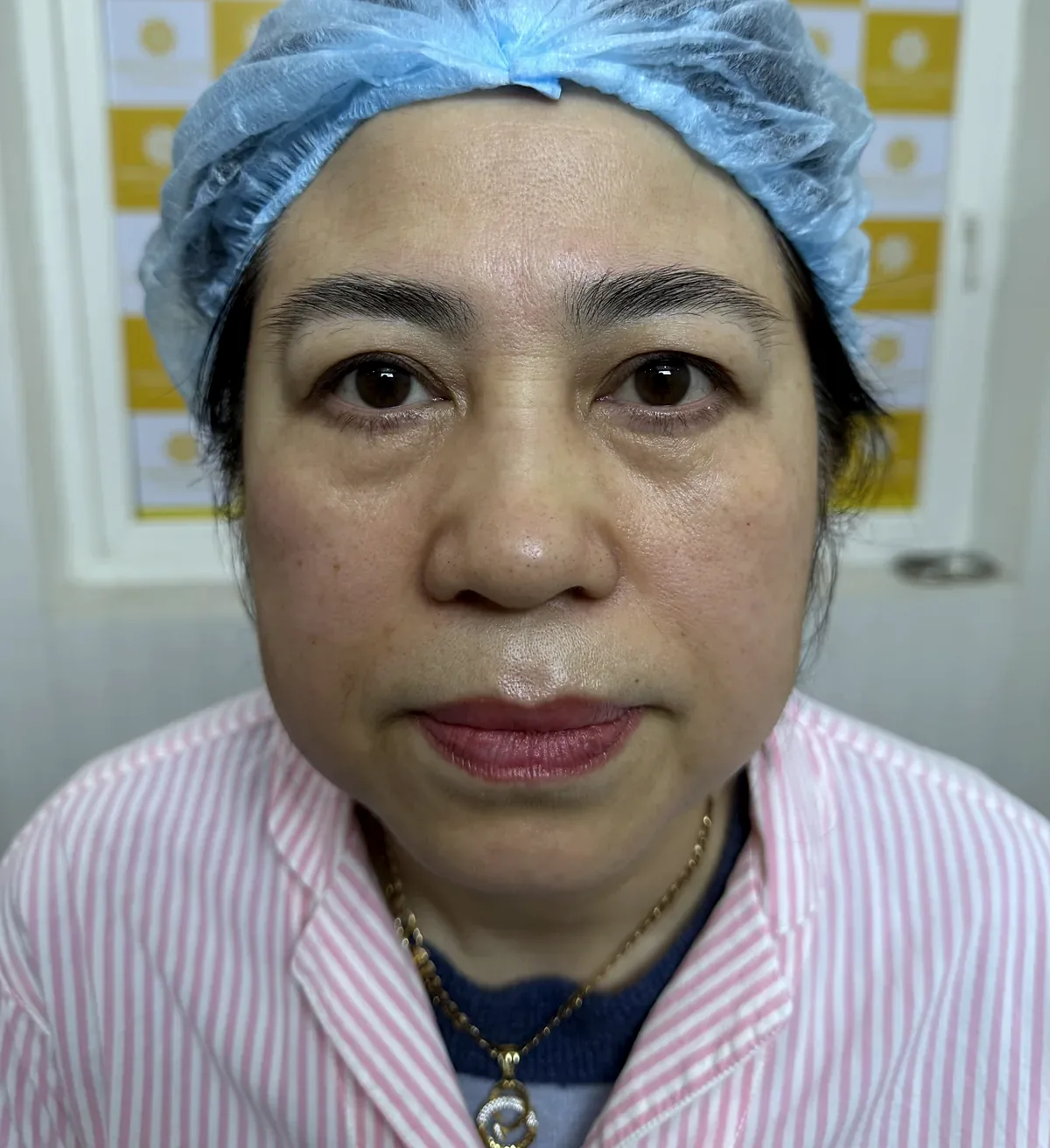 Before surgery
