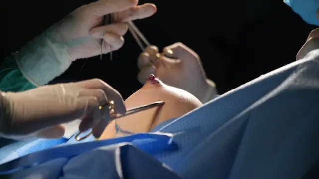 Quy trình đảm bảo an toàn phẫu thuật RASA