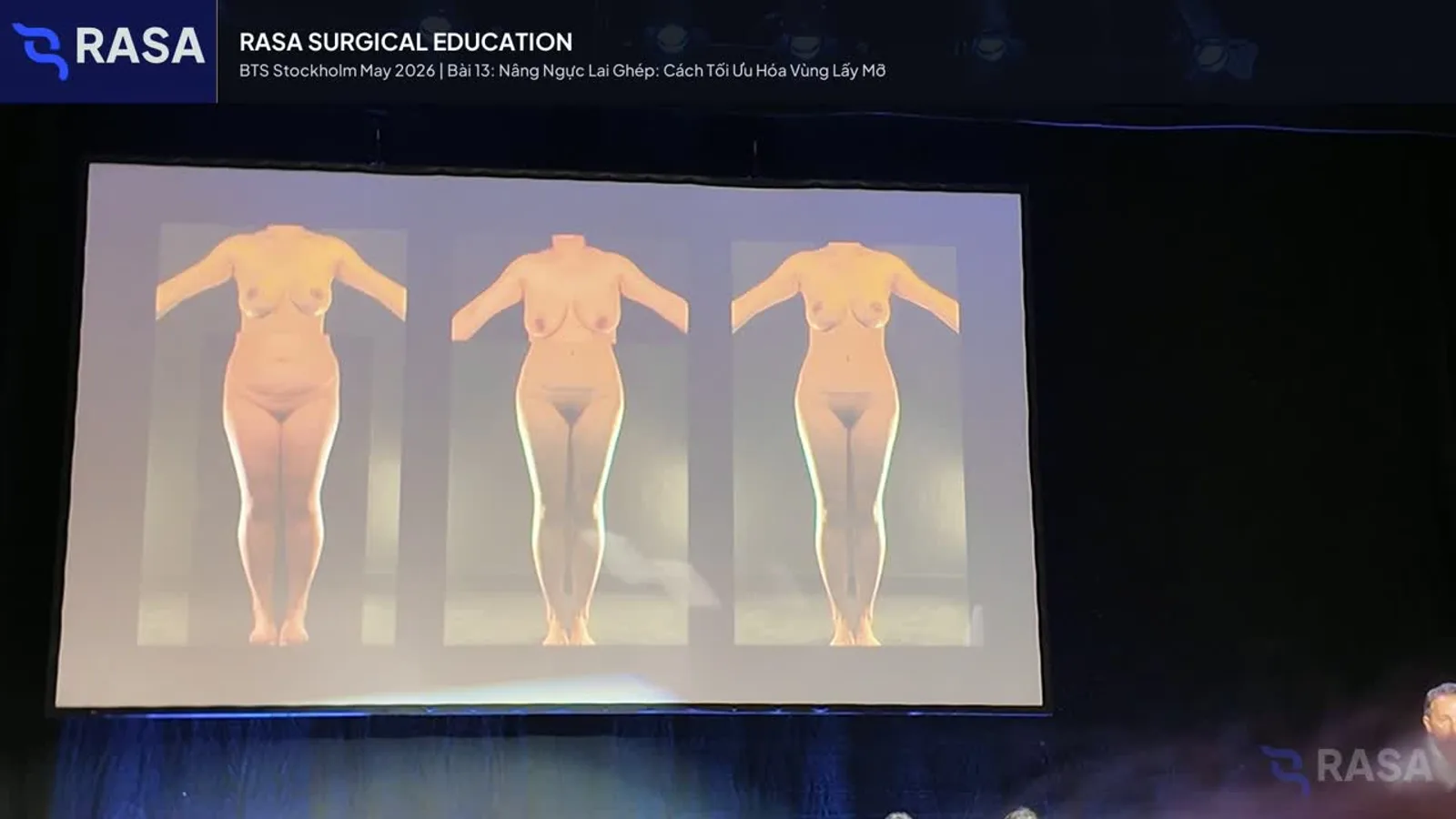 Frame from the hybrid augmentation and tissue planning block in BTS Day 2