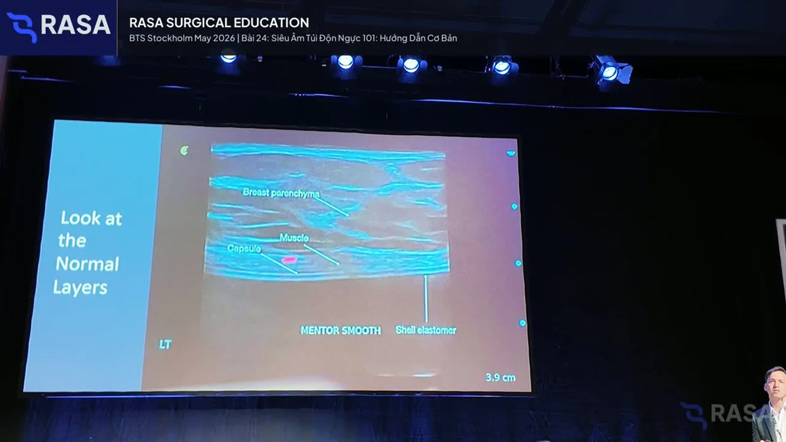 Frame from the breast implant ultrasound lecture in BTS Day 2