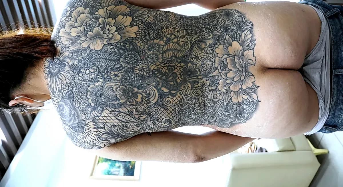 After surgery
