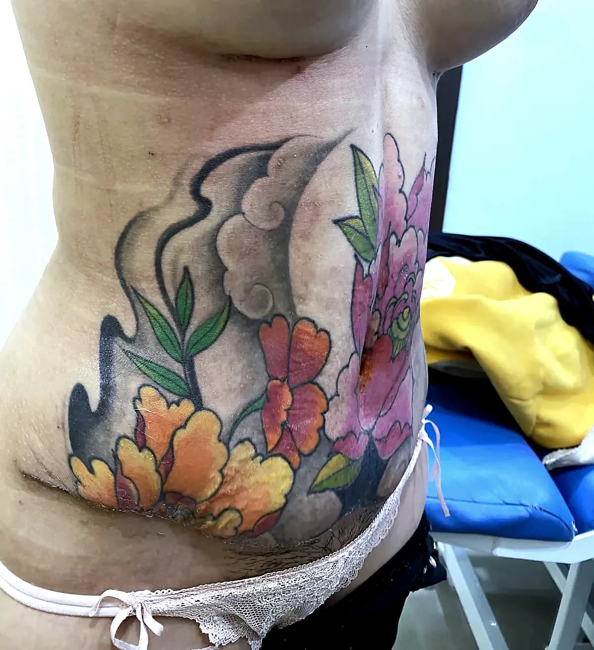 Before surgery