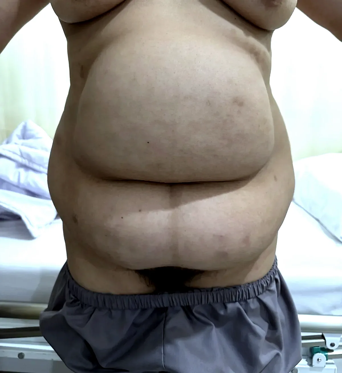 Before surgery