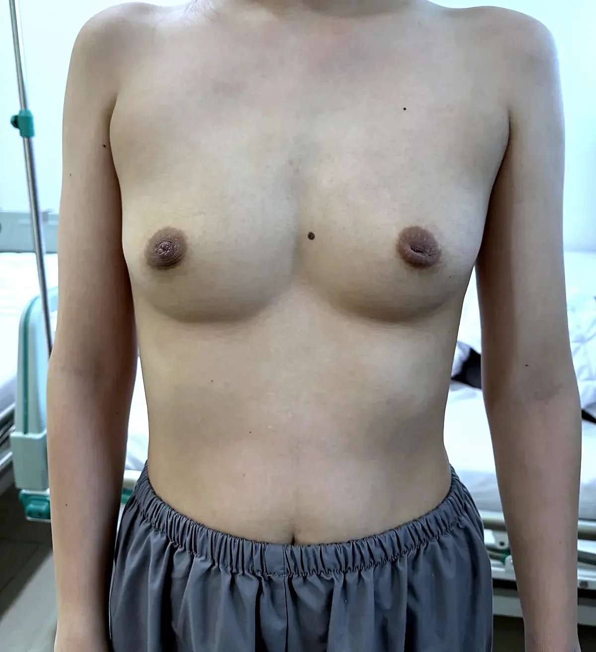 Before surgery