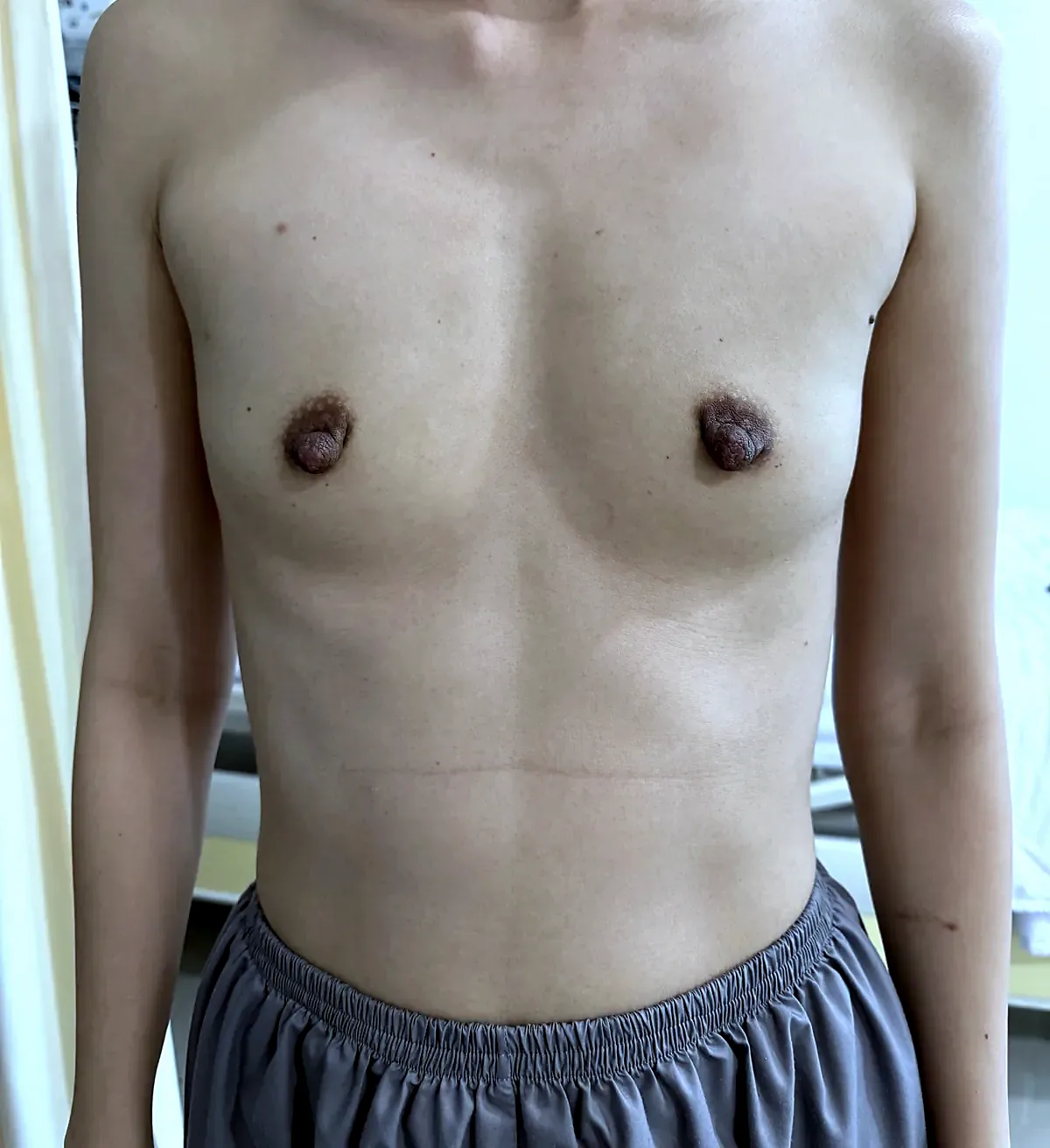 Before surgery