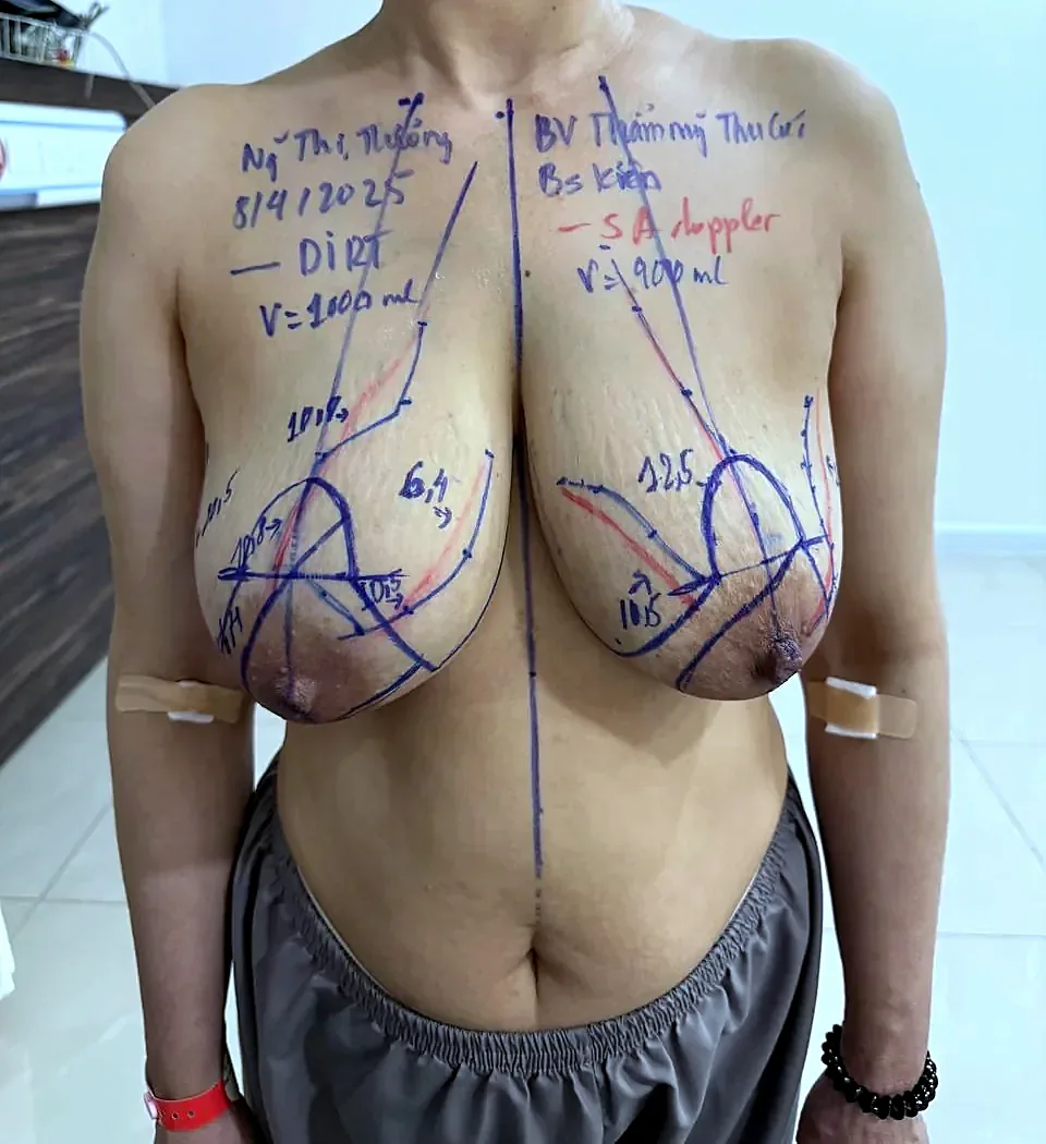 Trước phẫu thuật