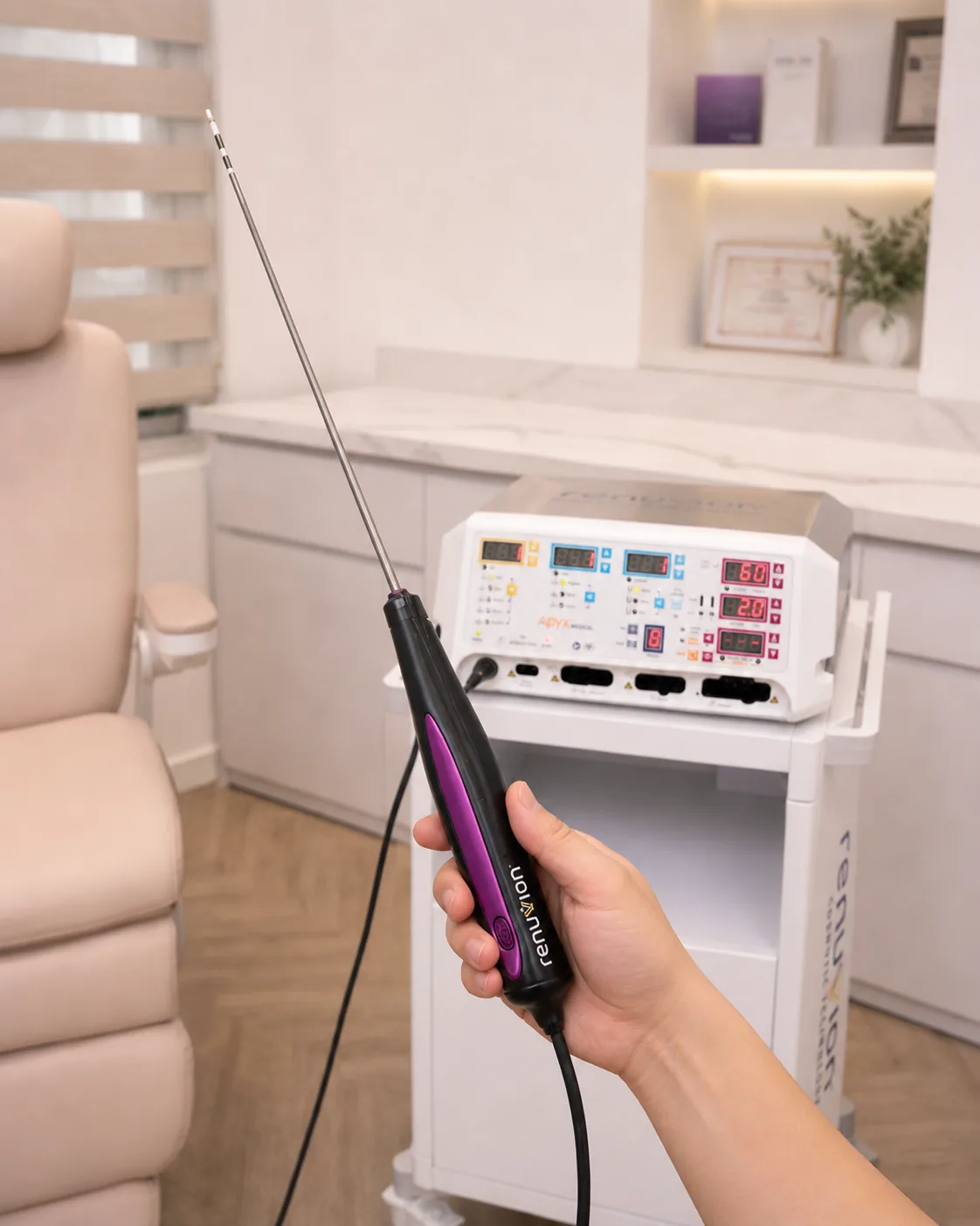Đầu phát năng lượng Helium Plasma được sử dụng trong các can thiệp hỗ trợ co hồi mô.