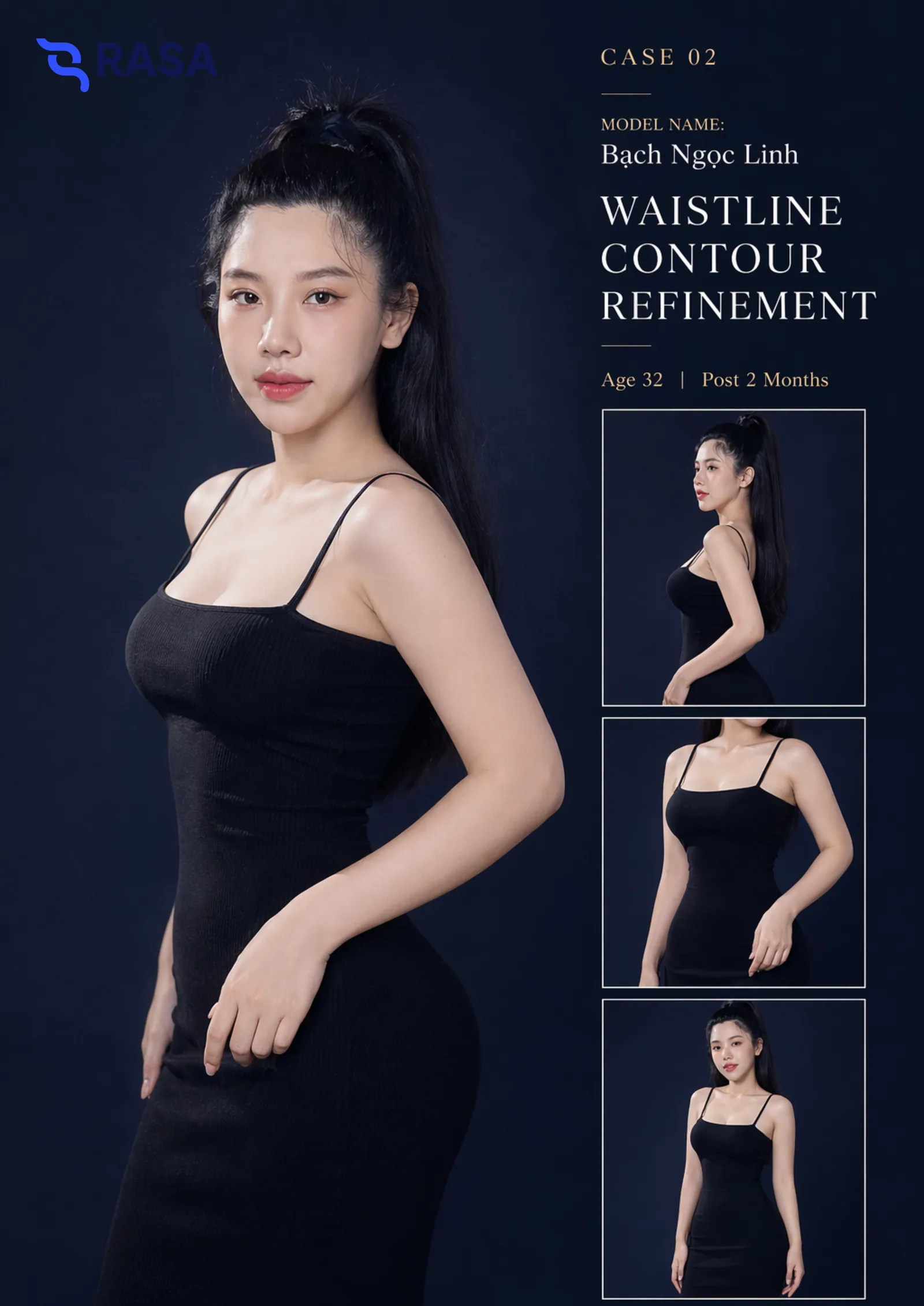 Contour refinement