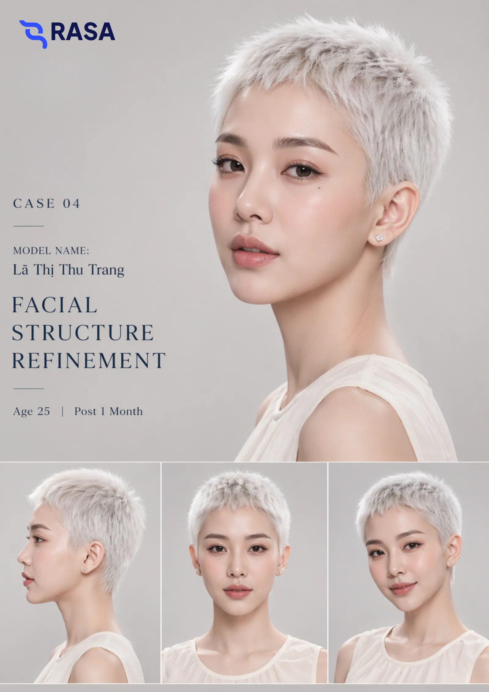 Facial structure refinement