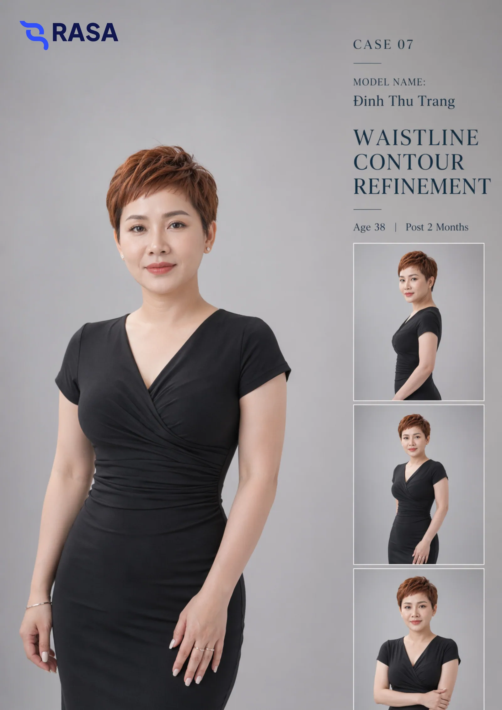 Aesthetic refinement
