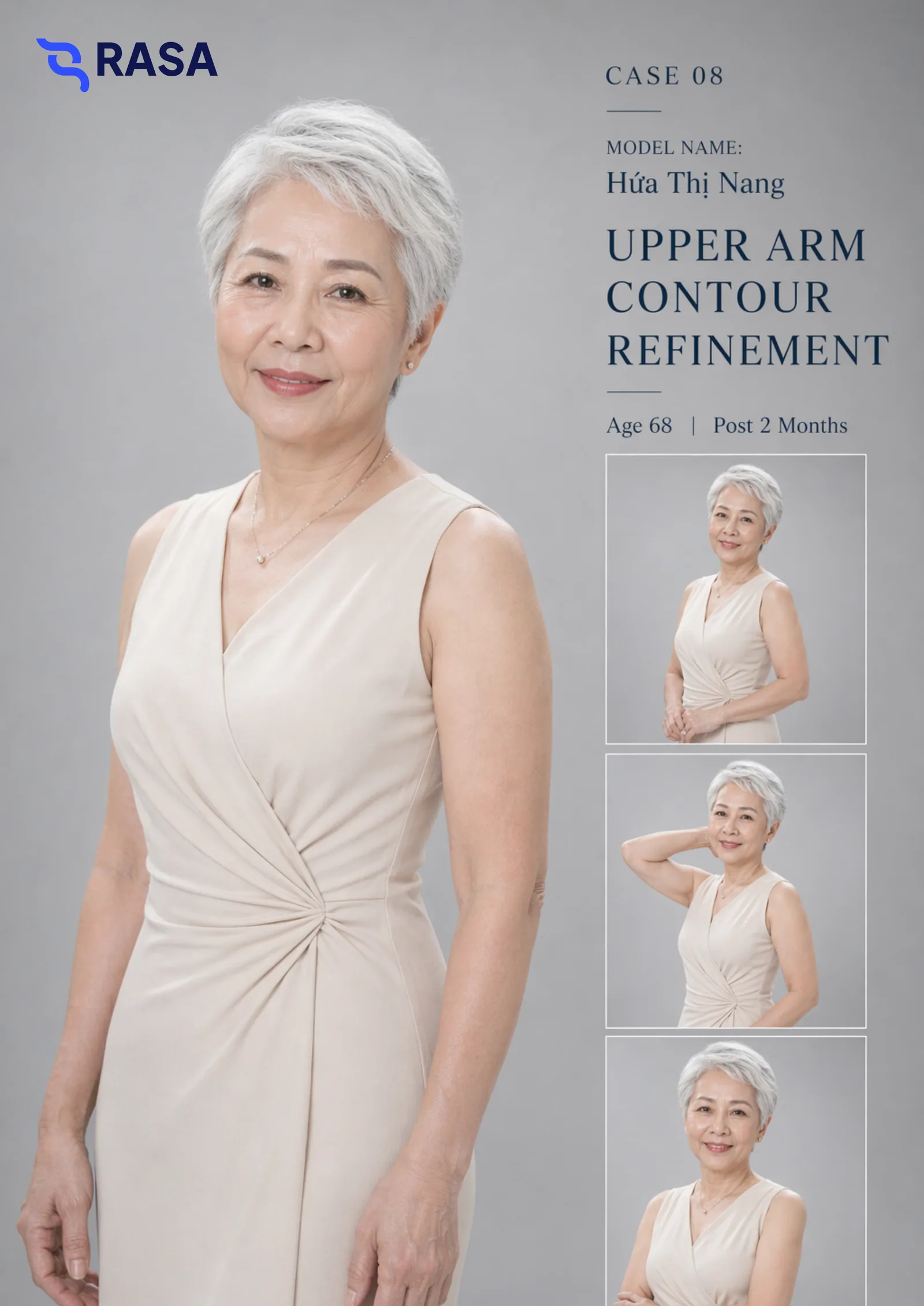 Aesthetic refinement