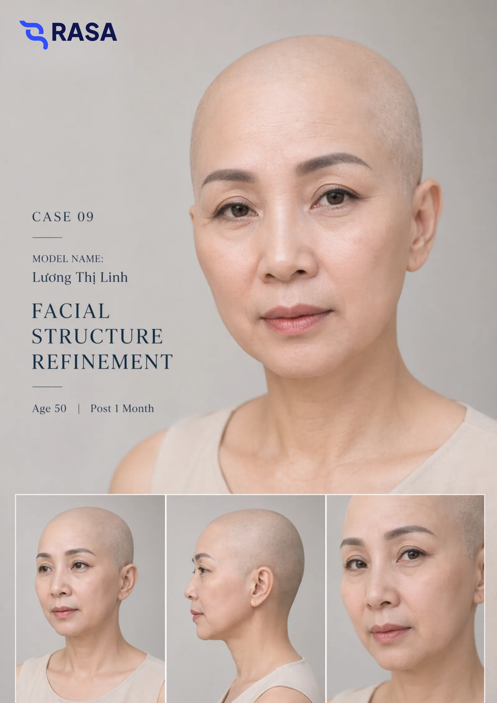 Aesthetic refinement