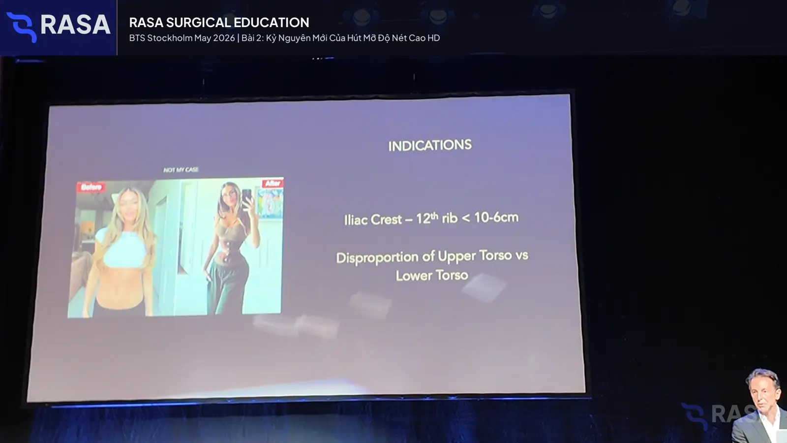 Frame from the high-definition liposuction lesson in BTS Day 1