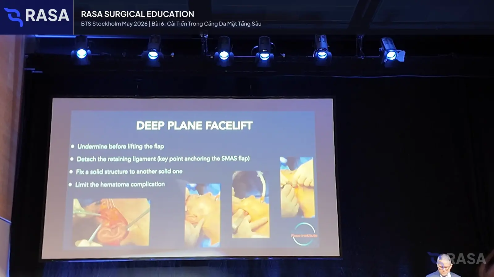 Frame from the deep plane face lifting lesson in BTS Stockholm 2026 Day 1