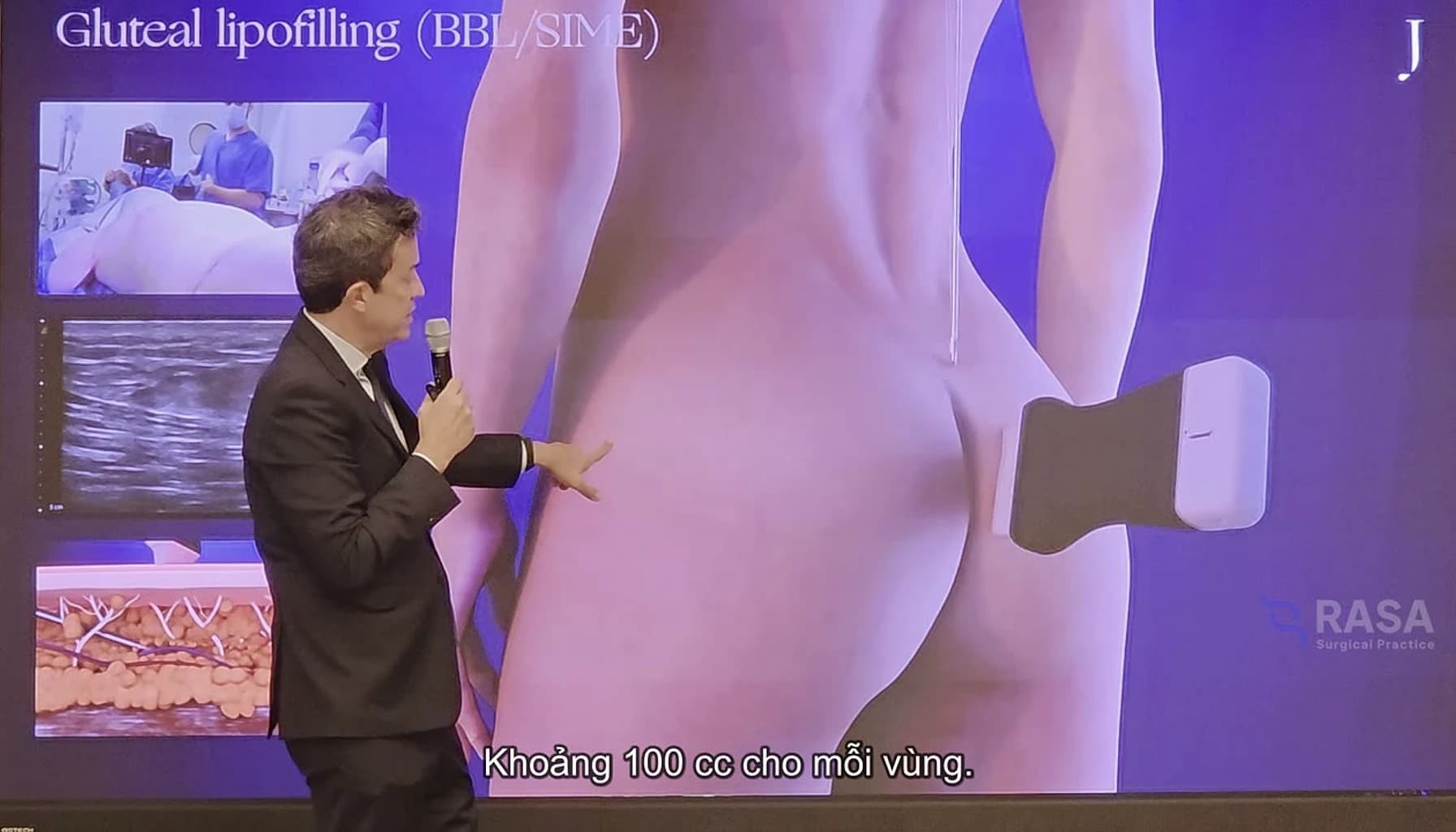 Dr Mir lecture frame on technology selection and tissue-layer control in body contouring