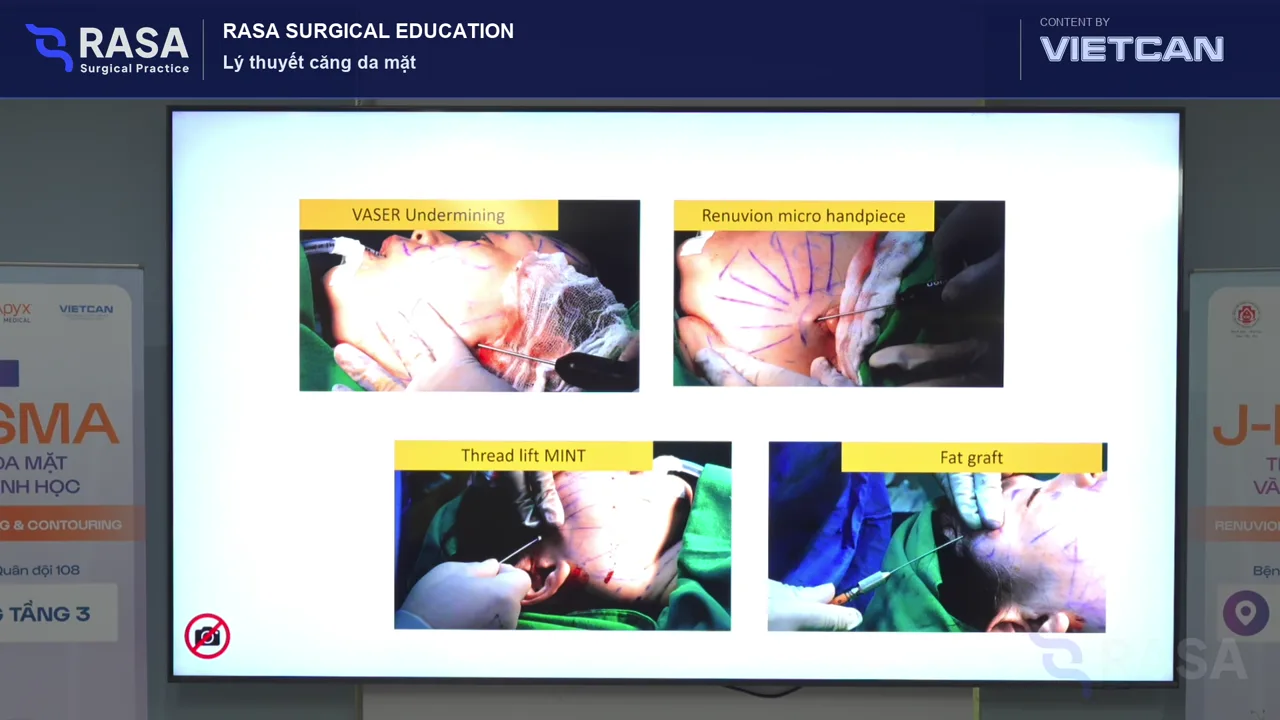 RASAxVietCan lecture frame showing multimodal treatment sequencing
