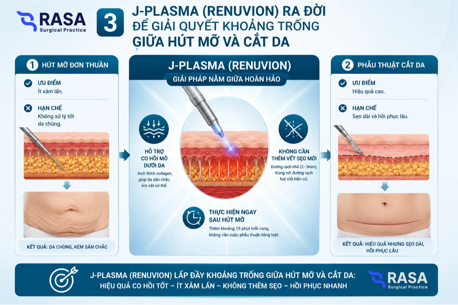 J-Plasma Renuvion ra đời để xử lý khoảng trống giữa hút mỡ đơn thuần và phẫu thuật cắt da.